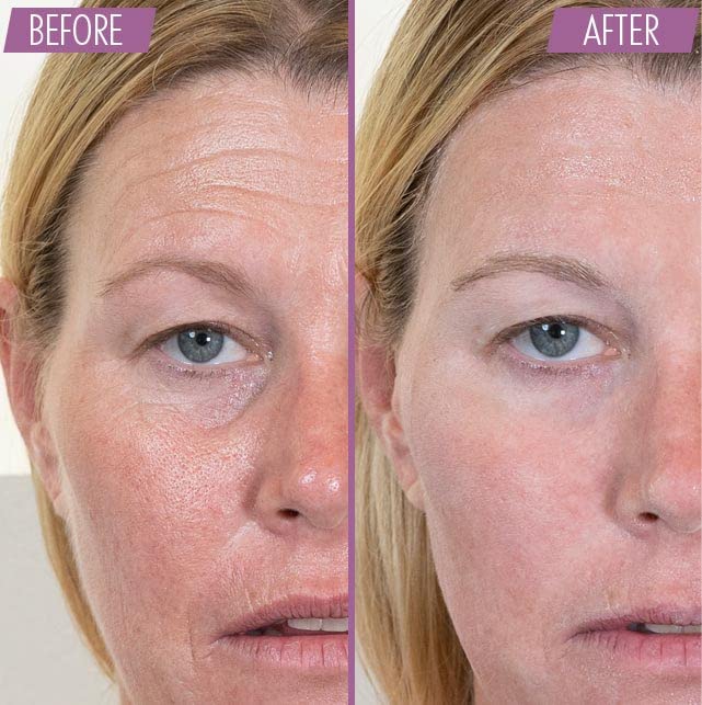 Athena 7 Minute Lift – Organic Lifting & Firming Serum – Visibly Tightens Eye, Neck & Face in 7 Minutes – Reduces Wrinkles & Fine Lines