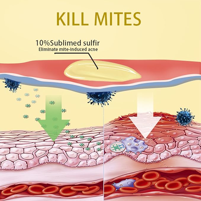 Tgideas Sulfur Soap Body Wash Shampoo - Deep Cleansing for Balancing Skin - Gentle Daily Care for Body and Scalp - 500ml for Men and Women