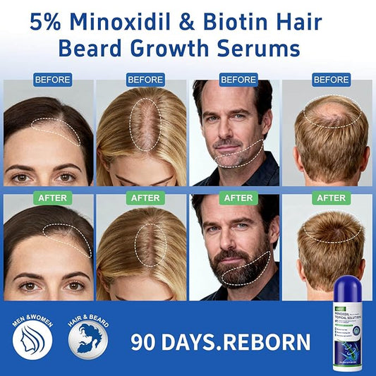 5% minoxidil hair growth Serum for women & men with biotin - with sponge applicator for thinning hair & receding hairline 8-month supply-6pcs Packs 2.71 fl oz per bottle