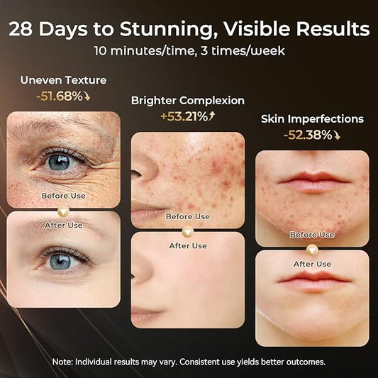 Red Light Therapy for Face-LED Face Mask Light Therapy with 3 Gears,2500mAh Battery,Remote Control,Infrared Red Light Therapy Mask for Home Working Travel Yoga Sleep