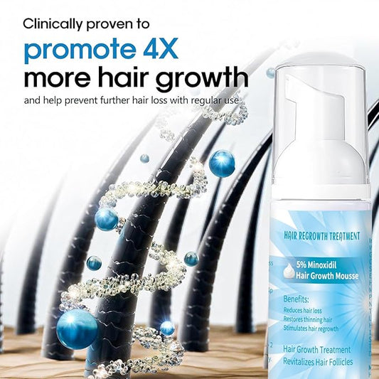 5% Minoxidil Foam for Men, Minoxidil for Women Hair Growth, Infused with Biotin, Hair Growth Treatment, Foam Hair Regrowth Treatment for Hair Thinning Receding Hairline,(2 oz Bottle), 3-Pack