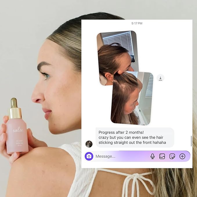 Salee- Dry Scalp Serum Nourishing & Moisturizing| Biotin, Caffeine For Thinning Hair, Reduce Shedding, Hydrate, Stimulate+ Hyaluronic Acid