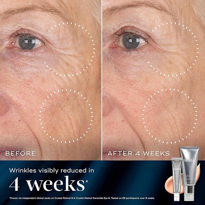 Medik8 Retinal Rewind Kit - Retinal Face Serum and Under Eye Cream for Puffiness and Wrinkles - Smoothing Serum for Face Hydrates Skin - 2 pc