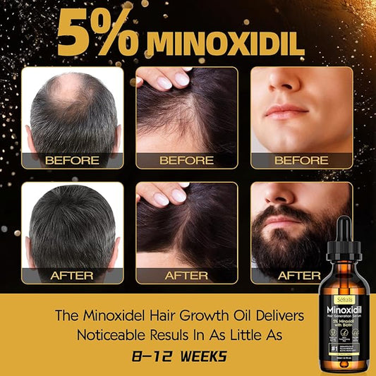 5% Minoxidil Hair Growth Serum Oil For Men and Women, Biotin Hair Serum, Safest Hair Regrowth Treatment, Prevent Scalp Hair Loss 60ml / 2.11 fl.oz