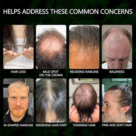 5% Minoxidil Hair Regrowth Treatment Kit for Men and Women, Minoxidil Spray Topical Solution with Scalp Massager for Hair Loss | Thinning | Hair Regrowth, Men Beard Growth Spray Kit