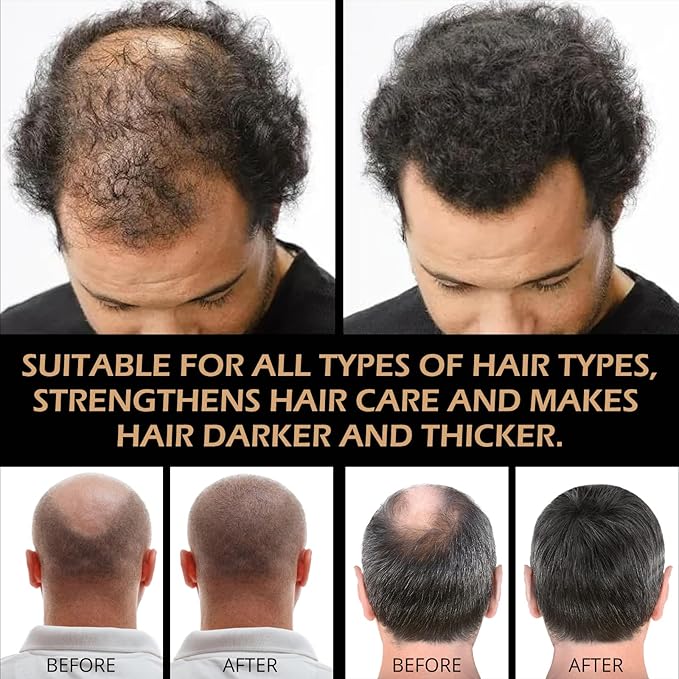 Root Activator Shampoo for Men-Hair Growth Shampoo for Hair Loss and Thinning Hair | Thickening & Nourishing For All Hair| Reduce Shedding,Smooths Hair, Unisex (200ML)