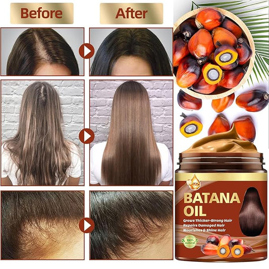 Batana Oil for Hair Growth & Rosemary Oil for Hair Growth,Raw Batana Hair Mask Rosemary Hair Growth Serum,Hair Loss Treatment,Hair Care for Dry Damaged Hair,Promotes Hair Thickness for Men Women