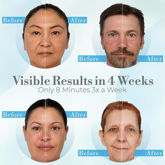 Red Light Therapy for Face – LED Face Mask for Eyes, Neck & Skin | Infrared Therapy Mask for Anti-Aging, Wrinkles, Skin Rejuvenation (HSA/FSA Eligible*)