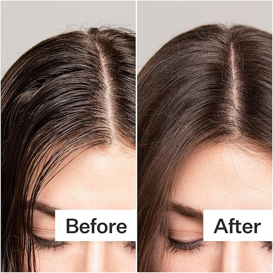 ACT+ ACRE Plant-Based Fulvic Acid Volumizing Dry Shampoo - Natural and Unscented Powder Spray Shampoo with Fulvic Acid and Rice Refresh Oily Hair and Restore Volume - Dry Shampoo for All Hair Types