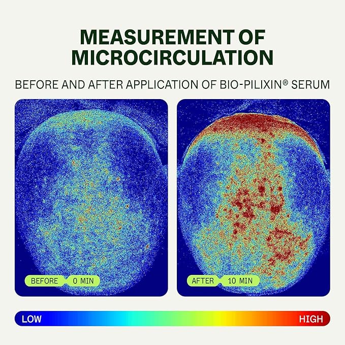 Scandinavian Biolabs Bio-Pilixin® Hairline Booster Refill | Hair Activation Formula, Does Not Include Rollerball Applicator, For Hairline Longevity, Vegan, 15 mL/ 0.5 oz (Pack of 3)