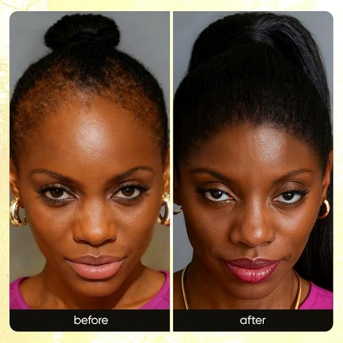 Root Revive Capsules – 90 Capsules | Supports Healthy, Thicker-Looking Hair | with Black Seed, Bamboo & Pumpkin Seed Extracts, Biotin & 17 Growth Ingredients