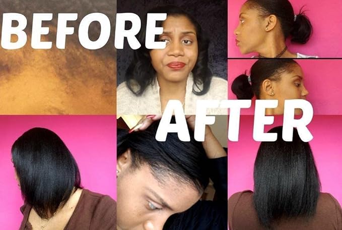 GOOD2GRO Hair Resuscitator with SureGro - 4oz | Repairs, Restores & Regrows Hair | Root-Activating with Tingling Sensation for Healthy Follicle Growth | Vegan & Cruelty-Free