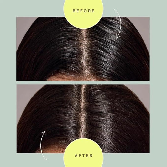 m'chel Day After Brush Dry Shampoo with Patented Applicator, Deodorizes and Removes Oil (Original Fragrance)