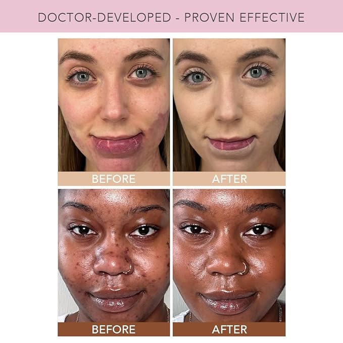 Doll 10 TCE Liquid Filter – CC Cream - Liquid Foundation - Lightweight Tinted Moisturizer & Skin Tint - Blurs Pores & Fine Lines - Vegan - Clean Makeup - [Deep/Rich] - 30 Day Supply