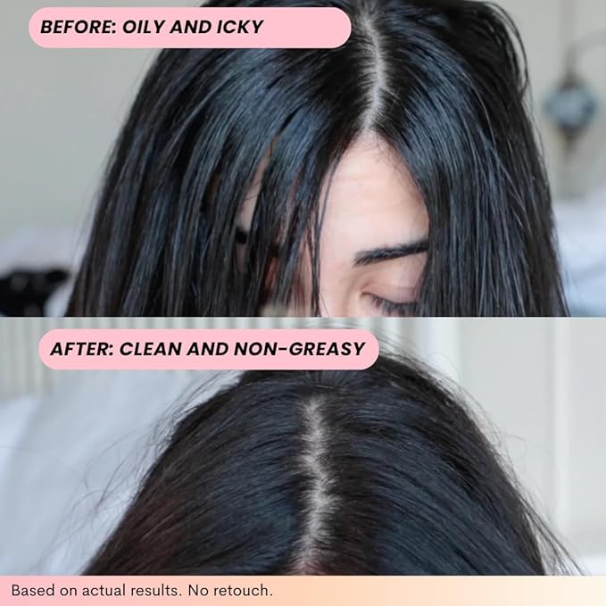 FoxyBae Volumizing Dry Shampoo Spray for Women - With Biotin for Hair Growth - For Dark, Brunette & Blonde Hair - Refreshing & Non-Toxic