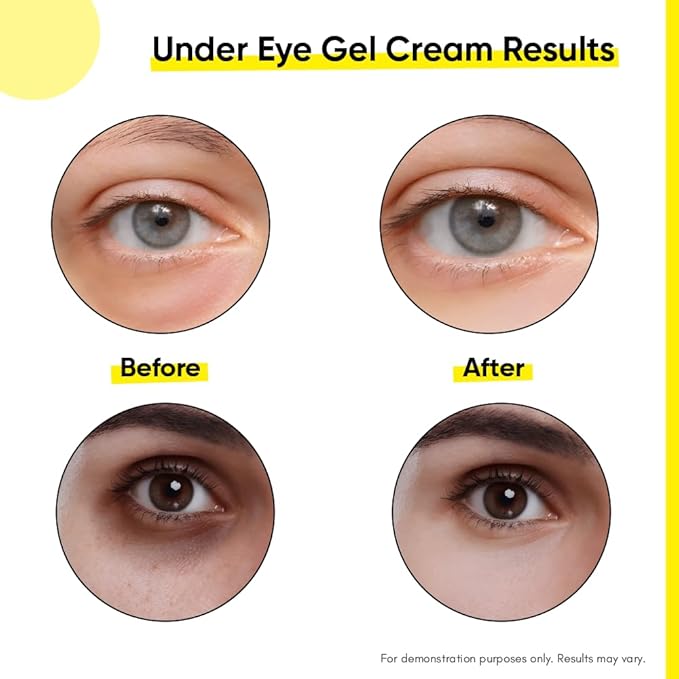 Under Eye Gel Cream with Retinol, Niacinamide, Caffeine, Vitamin C, & Aloe Vera Extract for Dark Circles, Fine Lines, and Puffy Eyes, For both Men & Women, 30ML