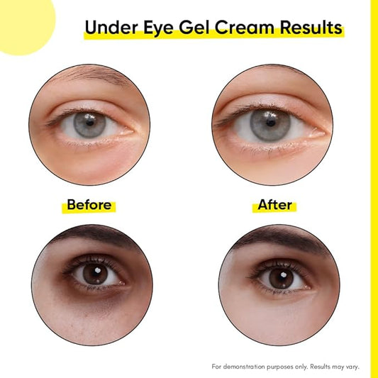 Under Eye Gel Cream with Retinol, Niacinamide, Caffeine, Vitamin C, & Aloe Vera Extract for Dark Circles, Fine Lines, and Puffy Eyes, For both Men & Women, 30ML