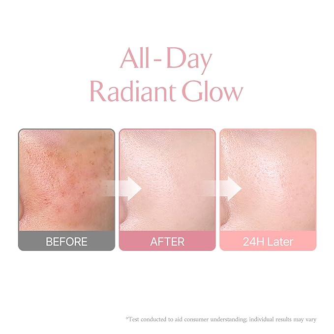 LA MUSE Glow Cushion Foundation No.20 Pure Ivory | Matches Your Skin Tone Perfectly | 65% Hyaluronic Acid Formula Moisturizes Dry Skin | Natural Radiant Glow, Smooth Texture | Light to Medium Coverage