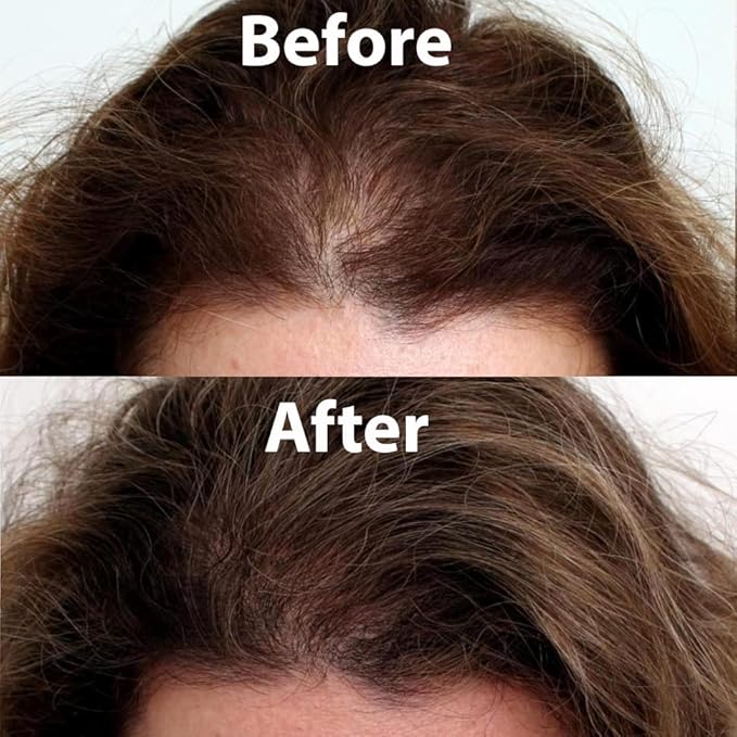 Cocoon Pomelo Grapefruit Oil Hair Tonic, Hair Growth Serum, Vegan Scalp Serum Treatment for Thinning, Damaged & Breakage Hair | Soften, Reduce Hair Loss & Promote Hair Growth | 4.73 fl oz