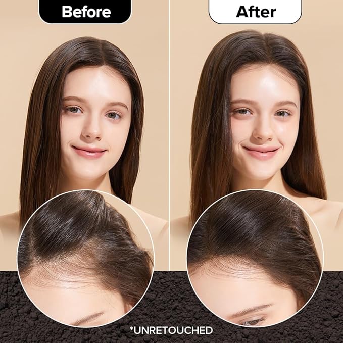 I DEW CARE Biotin Clarifying Dry Shampoo - Tap Secret Dark Brown | Strengthening & Volumizing, Powder Type, Refillable, Travel size, Non-aerosol, Brunette, Korean Ginseng, 0.26 Oz