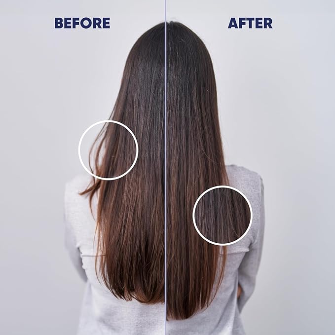 MOERIE Ultimate Hair Growth Serum for Natural Hair Regrowth & Thickening - Anti Thinning & Hair Loss Treatment for Women - Rapid Hair Growth Products - Scalp Oil Alternative - 1.69 fl oz, 3 pack