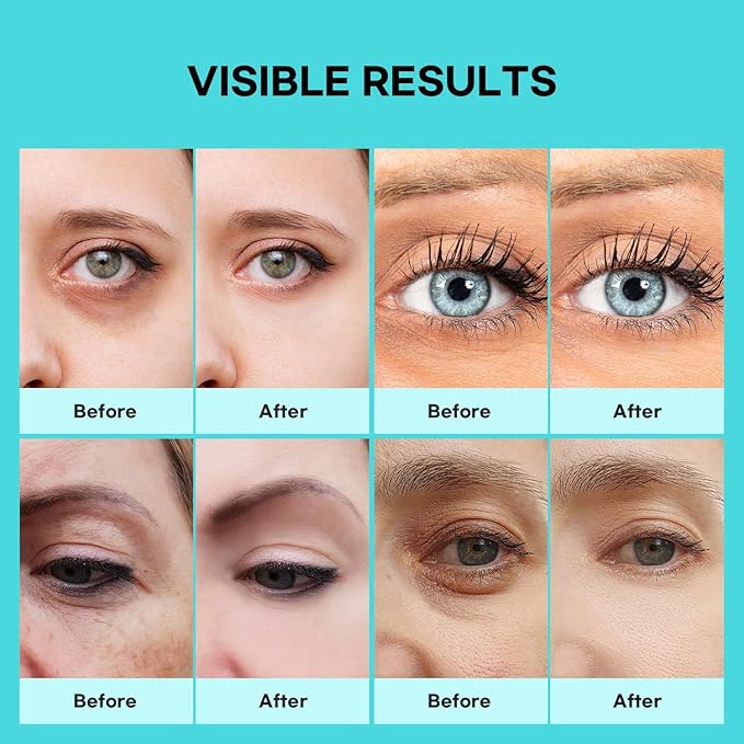 SLIKDERMIS Retinol Eye Cream for Dark Circles: Under Eye Cream for Wrinkles, Anti Aging - Eye Care, Advanced Formula Night Cream (30ml)