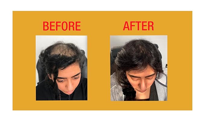 GOOD2GRO Hair Resuscitator with SureGro - 4oz | Repairs, Restores & Regrows Hair | Root-Activating with Tingling Sensation for Healthy Follicle Growth | Vegan & Cruelty-Free