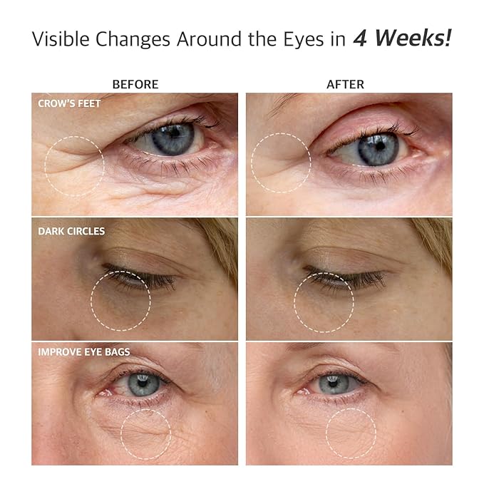 Snail Repair Eye Cream 1.01 fl oz - Anti-Aging & Hydrating Eye Cream with Snail Mucin, Peptides, and Niacinamide to Improve Skin Texture and Resilience, Korean Skincare