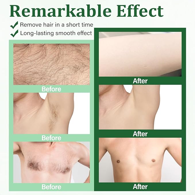 Wax Strips For Hair Removal, Waxing Kit For Women, Wax strips, Hypoallergenic, Facial Hair Removal for Women And Men, Waxing Hair Removeal Kit with 80 PCS + 4 Calming Oil Wipes(Green, Pack of 80)