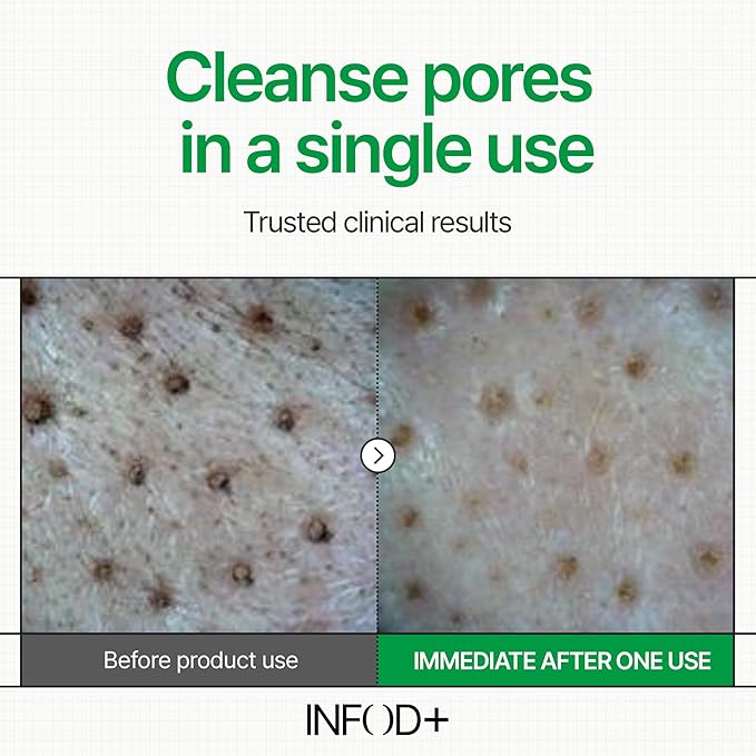 INFODPLUS XCESPI316 Gel Cleanser – Exosome & Walnut Powder Foaming Face Wash for Deep Pore Cleansing, Oil Control & Blackhead Care | Korean Cleanser for Men & Women, 100ml