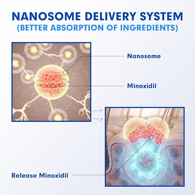 Fytikal 5% Minoxidil for Men Hair Regrowth Treatment, Extra Strength Topical Solution for Thinning Hair & Balding, Beard Growth Enhancer, Non-Greasy Fast-Absorbing Formula, 3-Month Supply