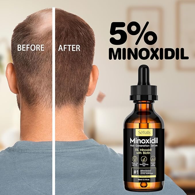 5% Minoxidil Hair Growth Oil for Men & Women - Extra Strength Regrowth Serum, Topical Hair Loss Treatment Serum, Thicker, Healthier Hair & Beard Growth, 2.11 oz