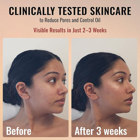 ADM Anti Aging Pure Retinol Serum For Face with Niacinamide - Resurfacing, Smoothing Fine Lines, Wrinkles, Acne Scars - Moisturizing Facial Skincare Treatment for Sensitive Skin - 1oz