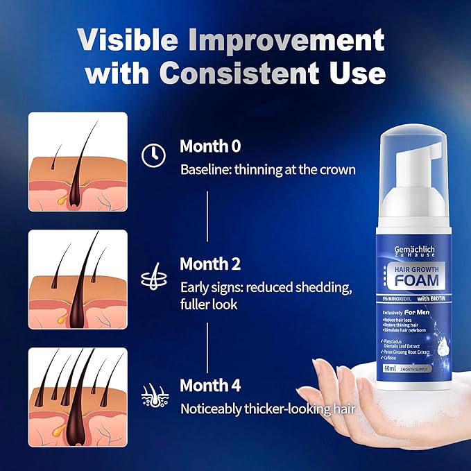 5% Minoxidil Foam for Men Hair Growth - Hair Regrowth Serum Treatment with Biotin, Caffeine, Rosemary Extract - Hair Loss Solution for Helps Prevent Thinning, Thickening Fuller Hair, Non-Greasy - 60ml