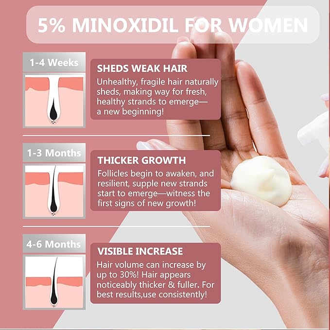 5% Minoxidil Hair Growth Foam - Men and Women Suitable for Hair Thinning Receding Hairline and Hair Loss to Hair Regrowth Get Thicker Fuller Hair for Women and Men