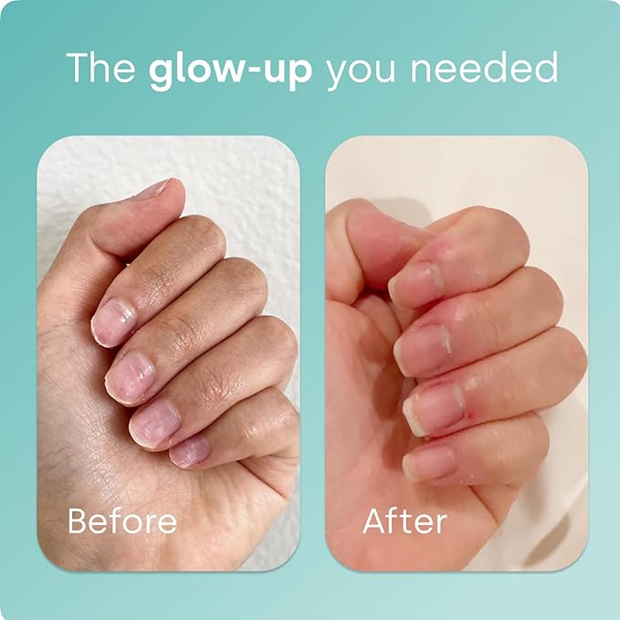 Biosil Collagen Booster Supplement - 60 Vegan Capsules - Patented ch-OSA Activator for Skin, Hair, Nails & Joints - Supports Natural Production - 30-Day Supply