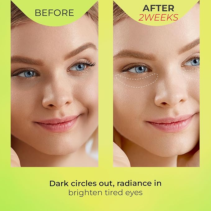 Look at Me Teen Again Dark Circle Eye Cream, Anti-Aging Line Smoothing Skin Care Treatment, Wrinkle Care, Cruelty Free, for Women and Men 0.84 fl. oz 25 ml