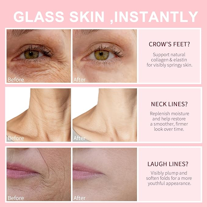 Retinol Collagen Hyaluronic Acid Anti-Aging Wrinkle Cream for Face & Neck Moisturizer Face Cream for Women 1.7 FL OZ