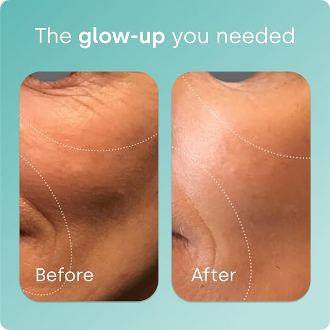 Biosil Collagen Booster Supplement - 30 Original Capsules - Patented ch-OSA Activator for Skin, Hair, Nails & Joints - Supports Natural Production - 15-Day Supply