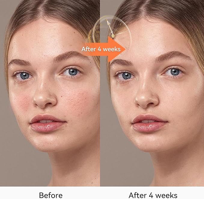 Red Light Therapy Face Mask with Infrared & LED Light – 4 Modes for Anti-Aging, Wrinkle Reduction, and Skin Rejuvenation – Lightweight, Rechargeable, Comfortable Design for Home Use