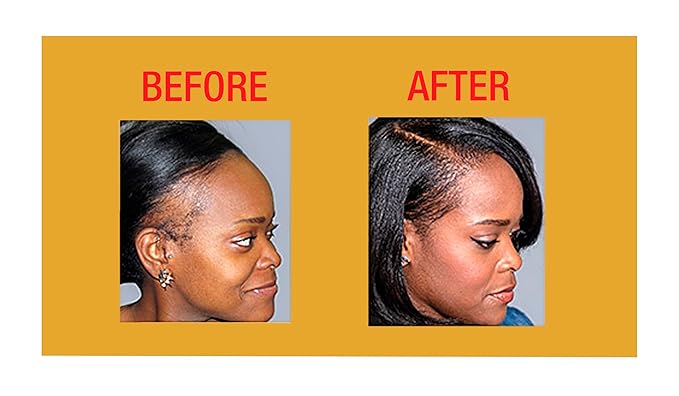 GOOD2GRO Hair Resuscitator with SureGro - 4oz | Repairs, Restores & Regrows Hair | Root-Activating with Tingling Sensation for Healthy Follicle Growth | Vegan & Cruelty-Free