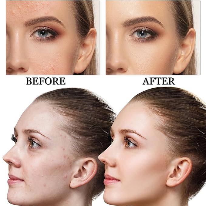 CAHIUYOA Mushroom Head Air Cushion CC Cream BB Cream Mushroom Head Foundation Full Coverage Foundation Makeup Long Lasting Moisturize Matte Concealer - 04 Nude