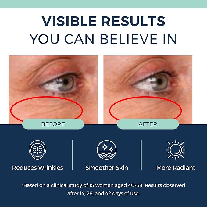 Anti-Aging Retinol Collagen Serum for Face- 1% Encapsulated Retinol, Niacinamide & Hyaluronic Acid Improves Wrinkles, Hydration, Skin Texture. Gentle for Sensitive Skin-Fragrance Free-1 FL OZ