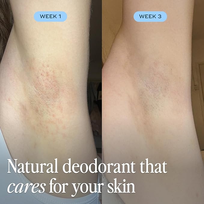 Luna Daily The All Over Deodorant™ Stick | Gel Deodorant for Women | Aluminum-Free, Non-Staining & pH-Balanced | Cooling Water Lily & Citrus | With Hyaluronic Acid & Prebiotics, 2.4 oz