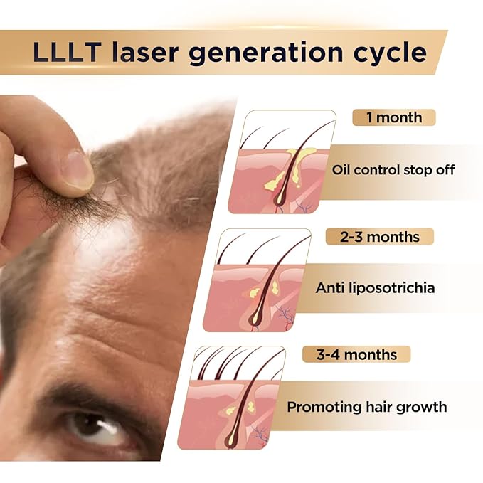 Red Light Therapy for Hair Growth Device - FDA Cleared Hair Loss Treatment - Laser Cap for Hair Regrowth - Hair Thinning & Alopecia Treatment for Men & Women