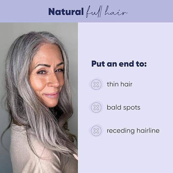 MOERIE Ultimate Hair Growth Serum for Natural Hair Regrowth & Thickening - Anti Thinning & Hair Loss Treatment for Women - Rapid Hair Growth Products - Scalp Oil Alternative - 1.69 fl oz, 3 pack