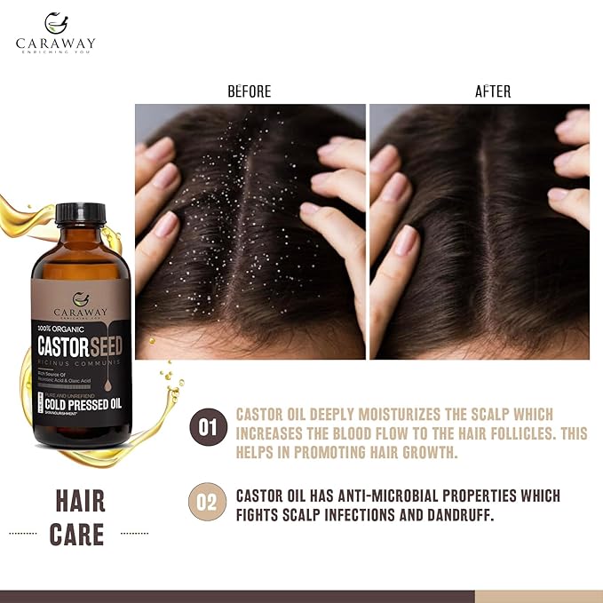 CARAWAY Cold Pressed Pure Castor Oil – Indian Handmade | Therapeutic Grade | Edible | For Liver Detox, Hair Growth, Eyelashes, Skin, Constipation & Joint Pain | Glass Bottle – 236ml