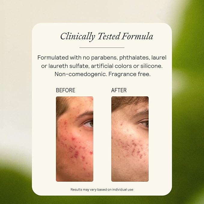 EQ Exfoliating Cleanser - EGCG + Quercetin - Gentle Face & Body Scrub - Cleanse & Exfoliate Skin - For Redness & Blemishes - With Squalene Oil & Ultra-Fine Walnut Shells -4.05 fl oz