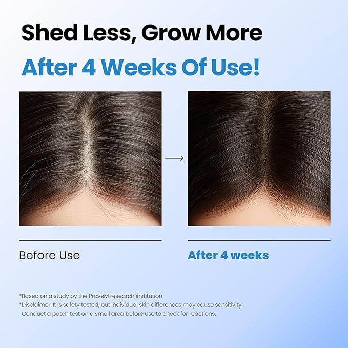 Scalpy Hair Growth Serum for Men & Women for Hair Loss & Thinning | Scalp Treatment with Salicylic Acid, Menthol, Dexpanthenol | Non-Greasy, Lightweight | Exfoliates Dandruff & Soothes Itch