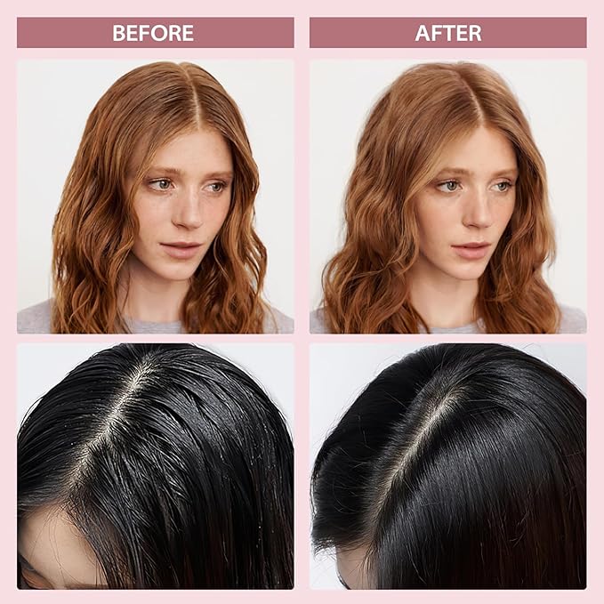 YLNALO Dry Shampoo Powder 2 Packs, Mattifying Root Fuller Looking Refreshing Hair,Non-aerosol, No White Cast, Travel Size Dry Shampoo Suitable for Women and Men,0.58Oz